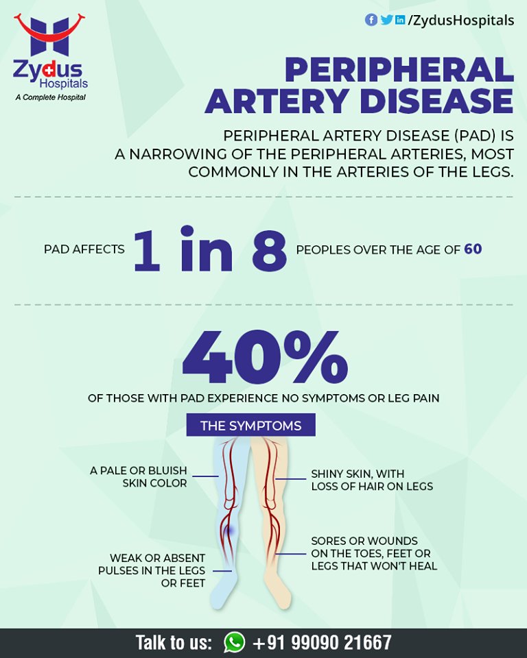 Peripheral artery disease (P.A.D.) is a disease in which plaque builds up in the arteries that carry blood to your head, organs, and limbs.

#PeripheralArteryDisease #BloodVessels #ZydusHospitals #HealthCare #ZydusCare #Ahmedabad https://t.co/XOZj1Nct6C