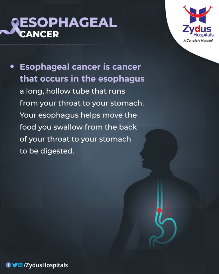 Esophageal cancer is cancer that occurs in the esophagus.

#EsophagealCancer #CancerCentre #ZydusCancerCentre #CancerCare #ZydusCare #ZydusHospitals #Ahmedabad #Gujarat https://t.co/UGpgLvgyEB