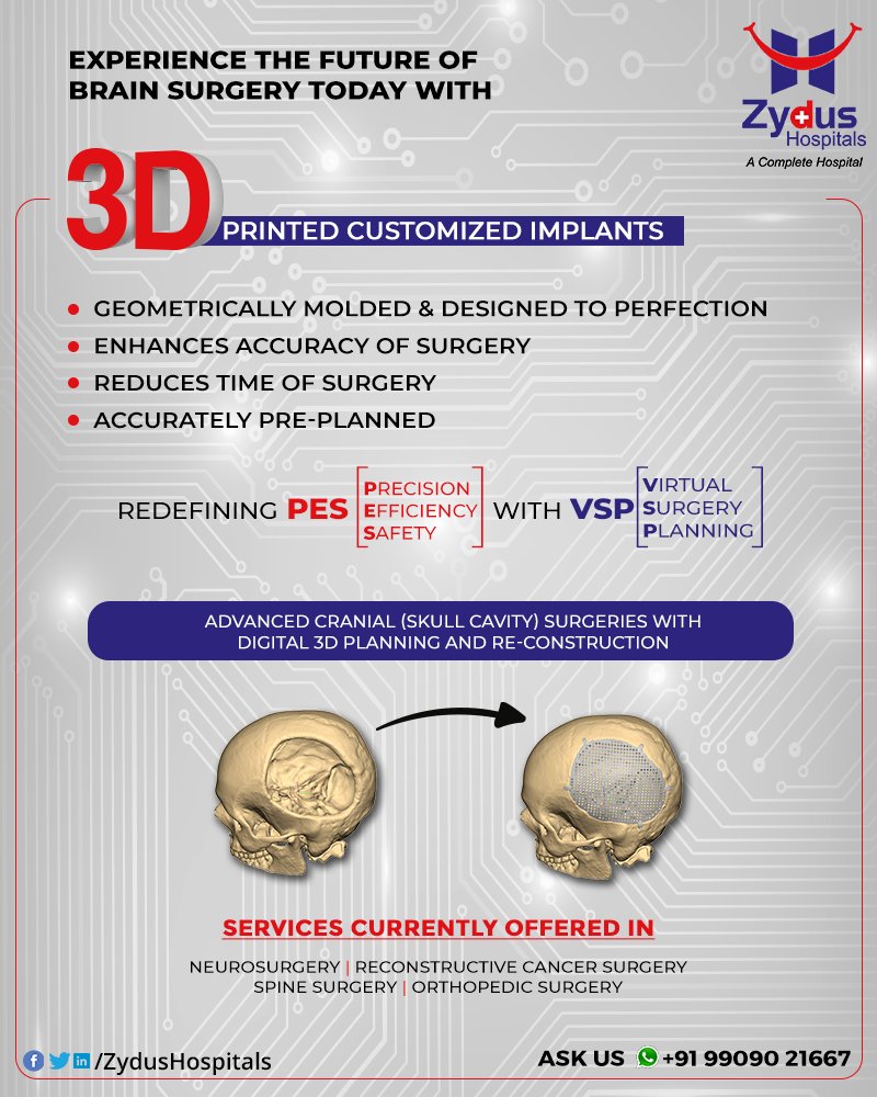The Future of Brain Surgery is here! - Customized 3 D Printed Implants for Neurosurgery.
Zydus Hospitals always strives to be ahead of the time offering global standard quality and advanced surgical planning techniques.
#BrainSurgery #Neurosurgery #Customized3DPrinted https://t.co/UOoQnvLhFT
