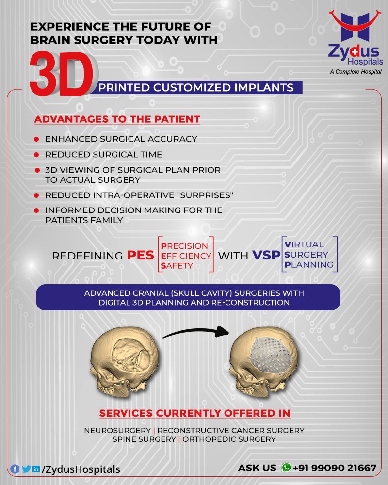 Zydus Hospitals is introducing 3D Printed Customized Implants which will redefine the current Brain Surgery Techniques with enhances surgical accuracy, reduced surgical time, incorporating Virtual Surgical Planning with Precision, Efficiency & Safety.
#BrainSurgery #Neurosurgery https://t.co/WaFGgpprTn