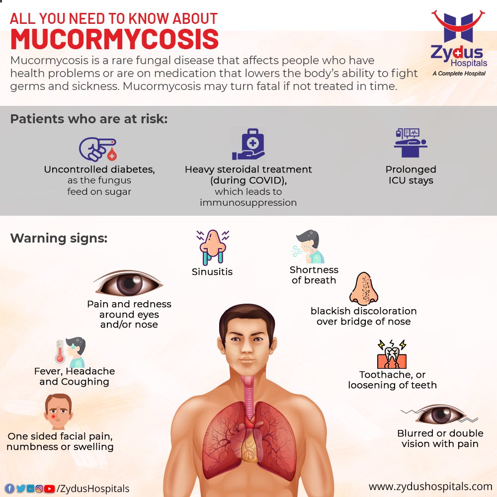Anyone who is diabetic and whose immune system is not functioning well needs to be on the guard against Mucormycosis or Black Fungus. 

#Mucormycosis #BlackFungus #Diabetes #Nose #Headache #FungalInfection #Infection #COVID19 #Pandemic #CoronaVirus #StaySafe #Immunity #Hospital https://t.co/sKKKBCR0xz