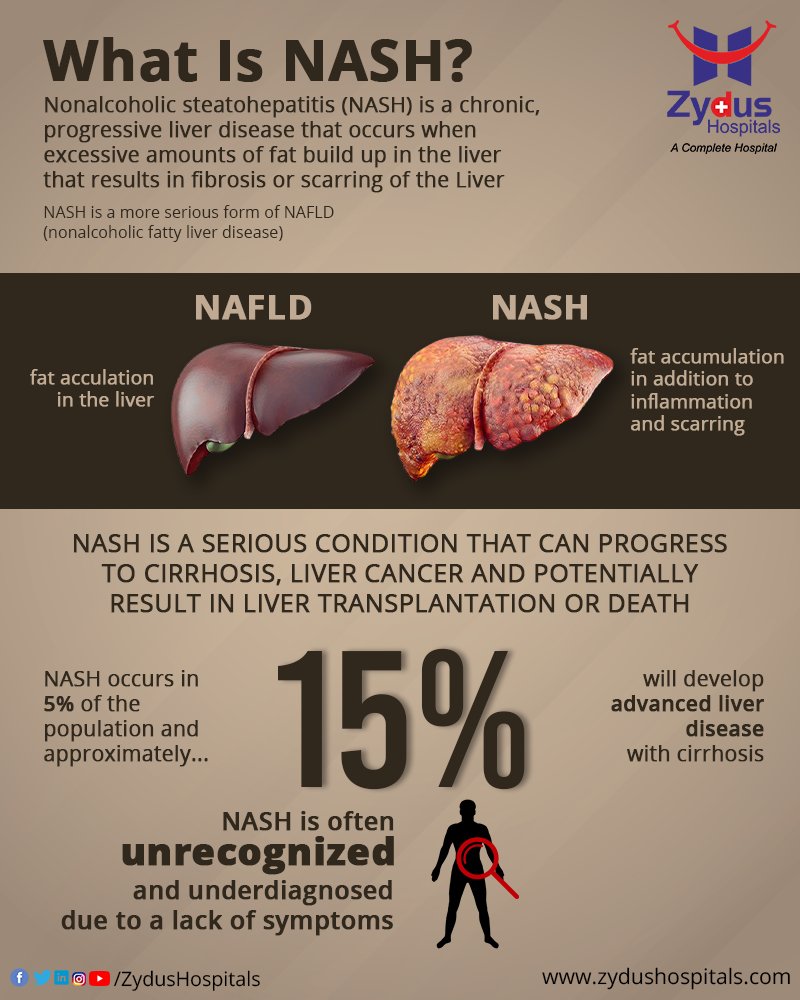 Having NASH basically means that you have inflammation and liver damage, along with fat in your liver. NASH is the form of Nonalcoholic Fatty Liver Disease (NAFLD), which is a silent disease with few or no symptoms. 
#NASH #LiverDisease #Steatohepatitis #Liver #Hospital #Health https://t.co/jJeJQJm001
