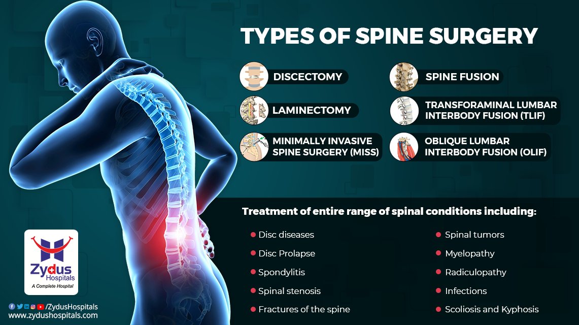 Stop struggling with your Spine issues any more; consult Spine experts and opt for the best opinion on which spine surgery is required to correct the issue.
#SpinalCord #SpinalCordInjury #Spine #Nerves #SafeSpineSurgery #SpineSurgery #SpineInjury #BackPain #Injury #ZydusHospitals https://t.co/KQzmG49AkB