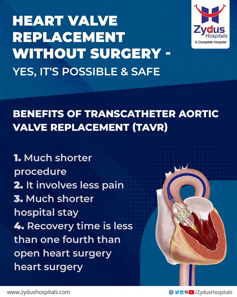 In the modern times, TAVR (Transcatheter Aortic Valve Replacement) has started gaining more popularity as compared to the old traditional methodologies because of its below mentioned merits:
 #TAVRAdvantages #TAVRBenefits  #Cardiology #CardiacSurgery #ZydusHospitals #ZydusCare https://t.co/JlFfEcZ37l