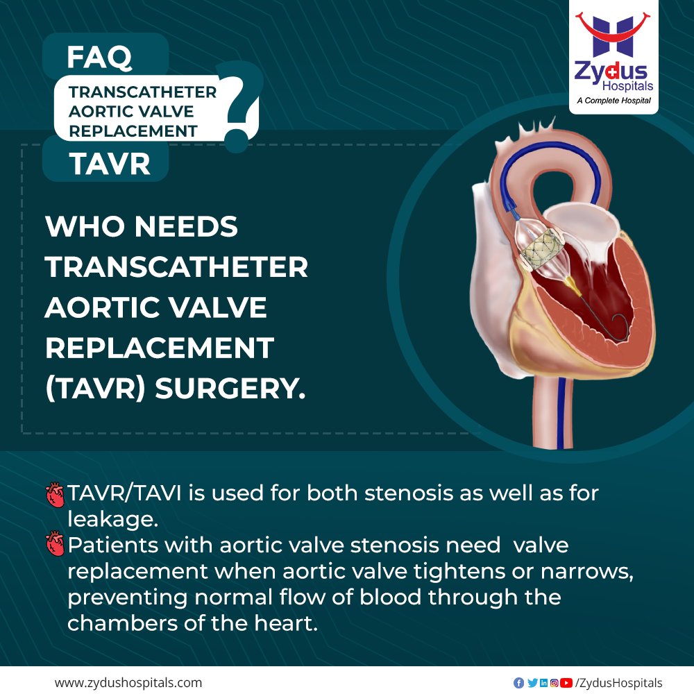 Zydus Hospitals takes the initiative to answer a few FAQs. Wear your glasses of curiosity and stay prepared right on time.
#FAQs #TAVR #TAVI #TranscatheterAorticValveReplacement #AorticStenosis #TAVRAdvantages #TAVRBenefits  #CardiacSurgery #ZydusHospitals #ZydusCare https://t.co/azkbL5CgBN
