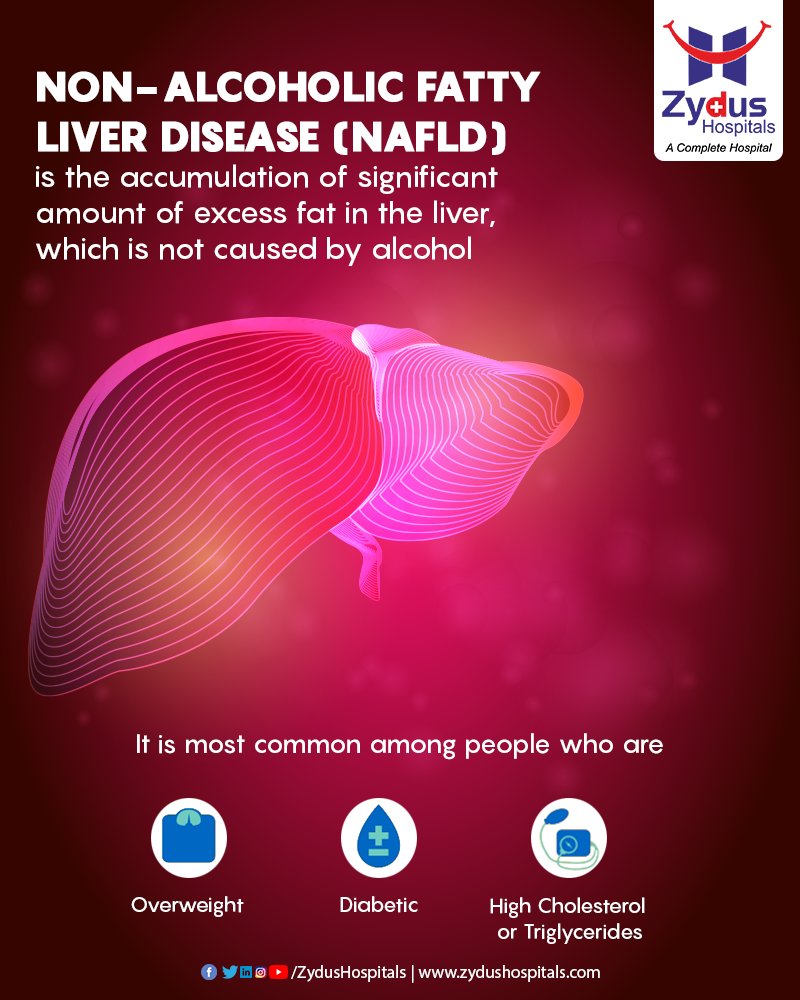 Are you facing similar symptoms?  

Make an appointment with us if you have persistent signs and symptoms that cause you concern.

For appointment call +9179 66190300

#NonAlcoholicFattyLiverDisease #Symptoms  #ZydusHospitals https://t.co/RtJTtJshcW