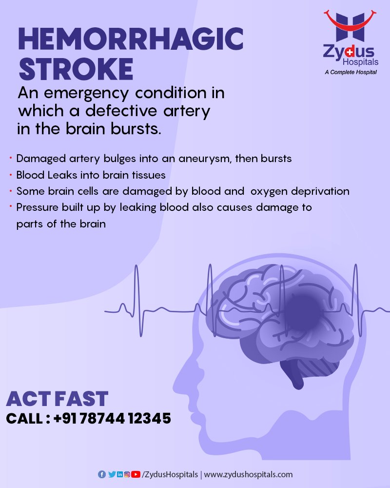 Recognizing the early symptoms of stroke is the best way to help a person get medical treatment quickly.

ACT FAST, Call: +91 78744 12345

#BrainStroke #HemorrhagicStroke #IschemicStroke #EarlySymptoms #BrainHealth #Neurology #NeuroCare #ActFAST #ZydusHospitals #Ahmedabad https://t.co/ODfo455kPV