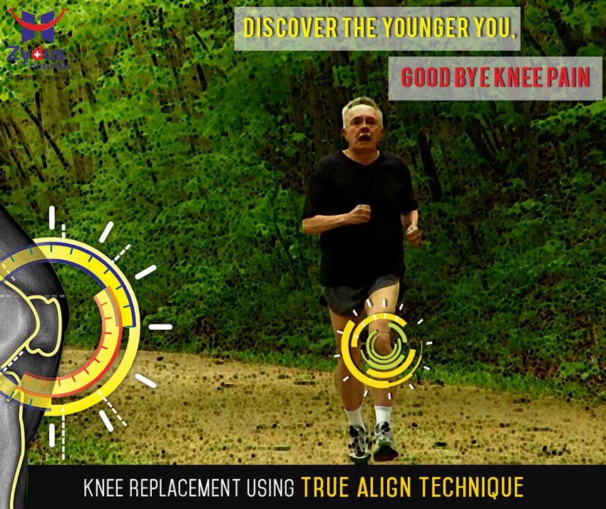 Zydus Hospitals presents the revolutionary knee replacement technique, #TrueAlign technology !
#ZydusHospitals https://t.co/X5CY5cHLCj