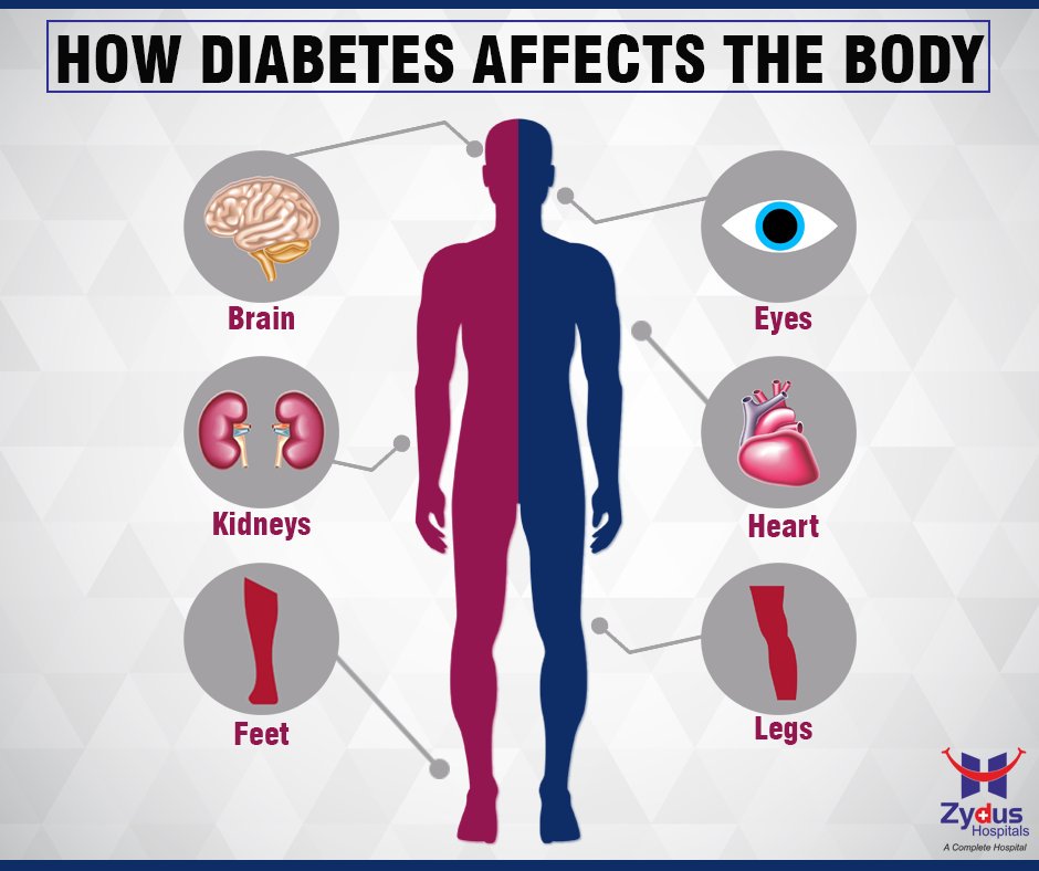 Diabetes can affect a number of areas in the body. 

#HealthCare #ZydusHospitals #Ahmedabad https://t.co/QkDaQdpEG8