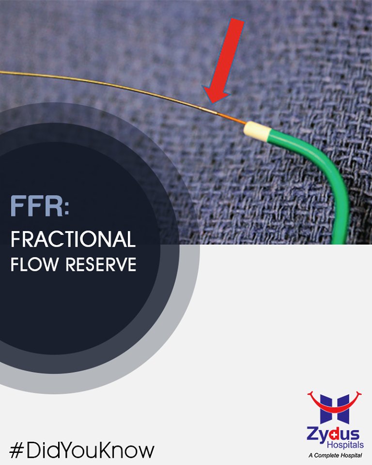 (FFR) is a technique used in coronary catheterization to decide the severity of coronary artery blockage. https://t.co/jSKIxFr61W